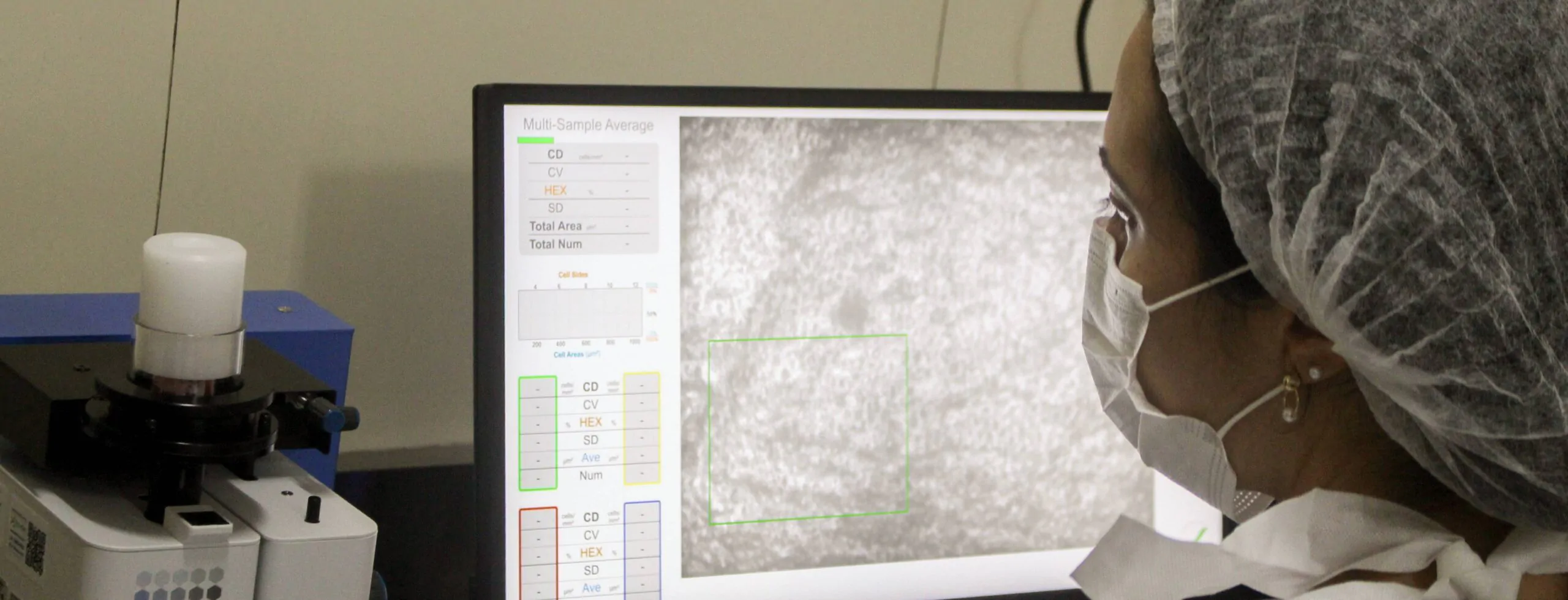 banco_de_corneas_HJXXIII_(7) (1) Rafael Assis