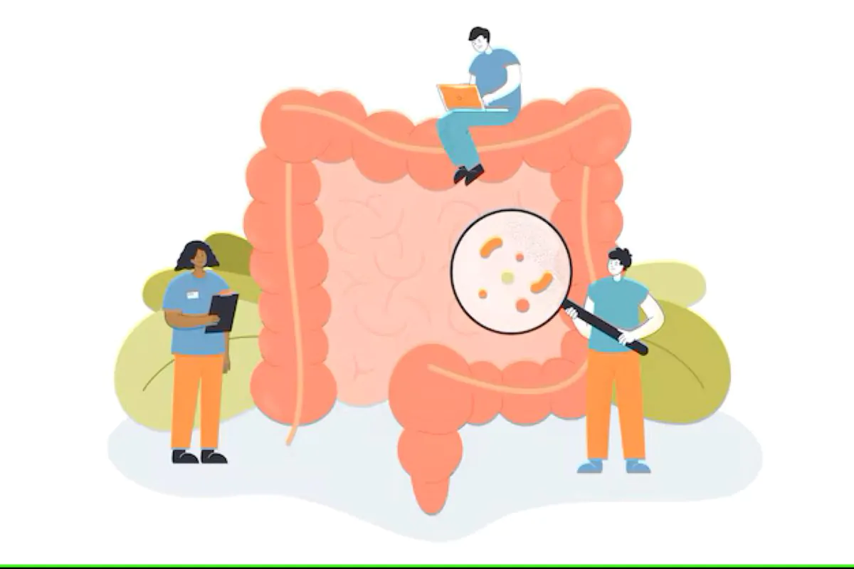 cancer de intestino 2